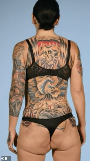 She was left with a saggy, misshapen backside