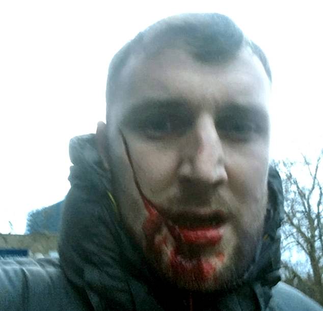 The fan walked away with a nasty slash to the face following the mass brawl before the game